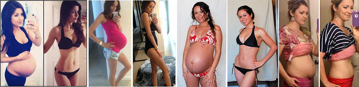magicfit pregnancy recovery before after